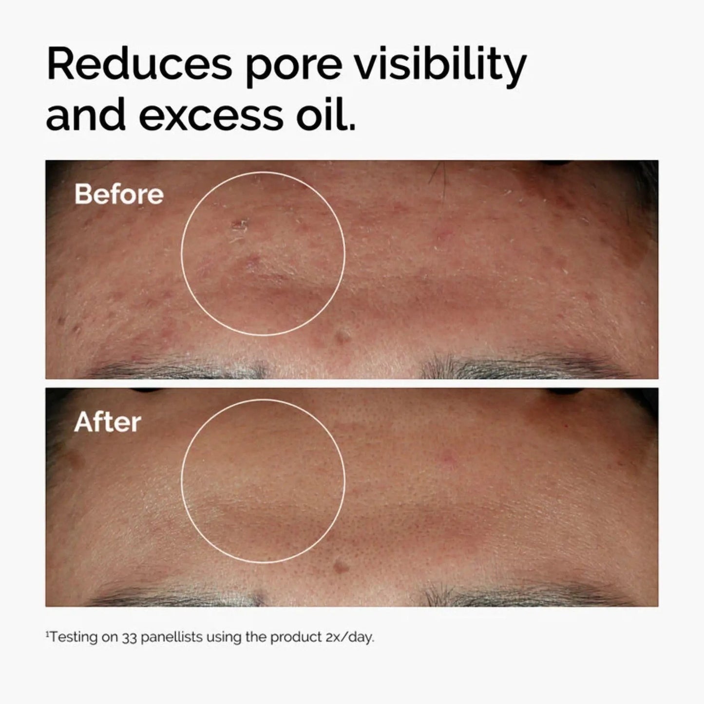 Ordinary Niacinamide 10% + Zinc 1% Serum 30 ML