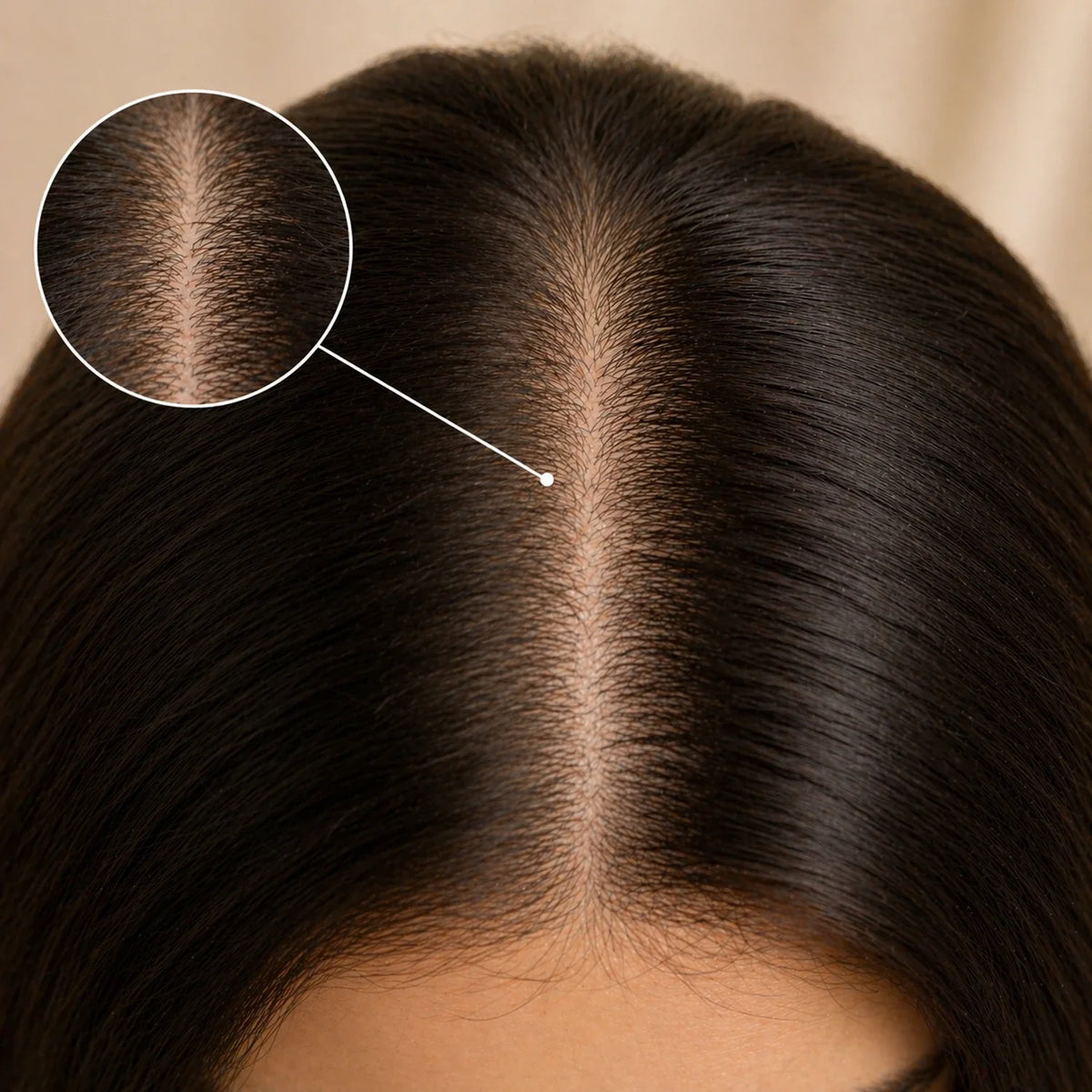 concern:hair-growth
