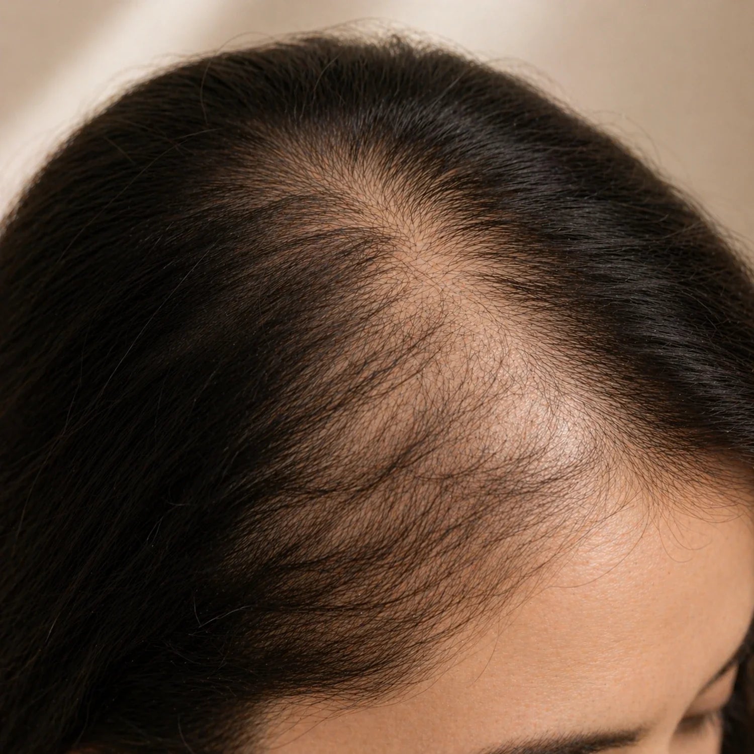 concern:hair-loss