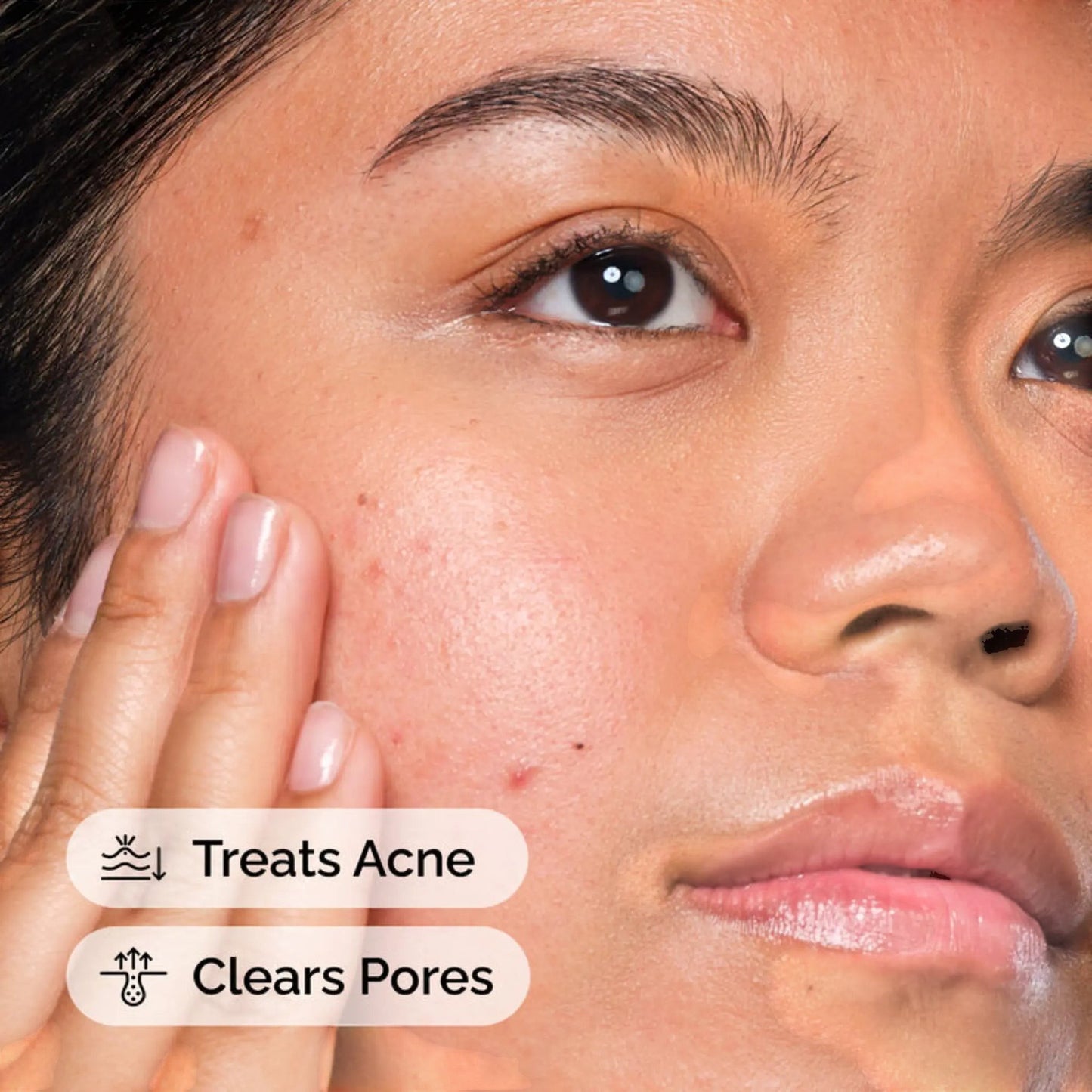 Ordinary Salicylic Acid 2% Solution Serum 30 ML